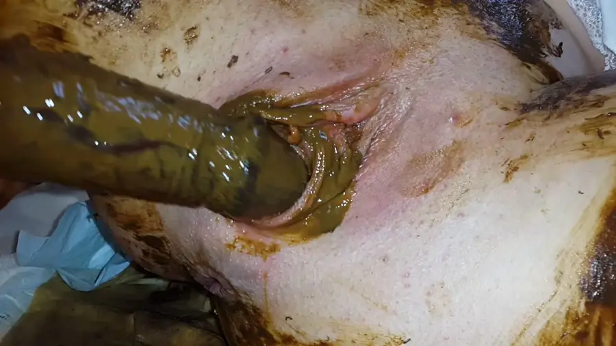 Scatting (Anna Coprofield) Gynecological Self-Examination Shit - Filled Pussy Thought The Speculum [FullHD 1080p] Pee, Solo, Shit