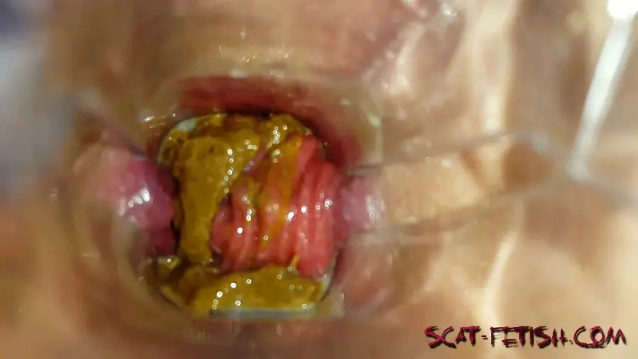 Defecation (Anna Coprofield) Speculum Play and Filled Pussy part 1 [FullHD 1080p] Scatology, Solo