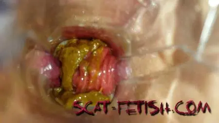 Defecation (Anna Coprofield) Speculum Play and Filled Pussy part 1 [FullHD 1080p] Scatology, Solo