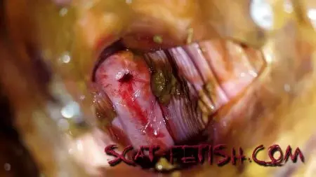 Poop Videos (Anna Coprofield) Shit and Blood Vol.5 Speculum Full version [FullHD 1080p] Slander, Bull, Solo