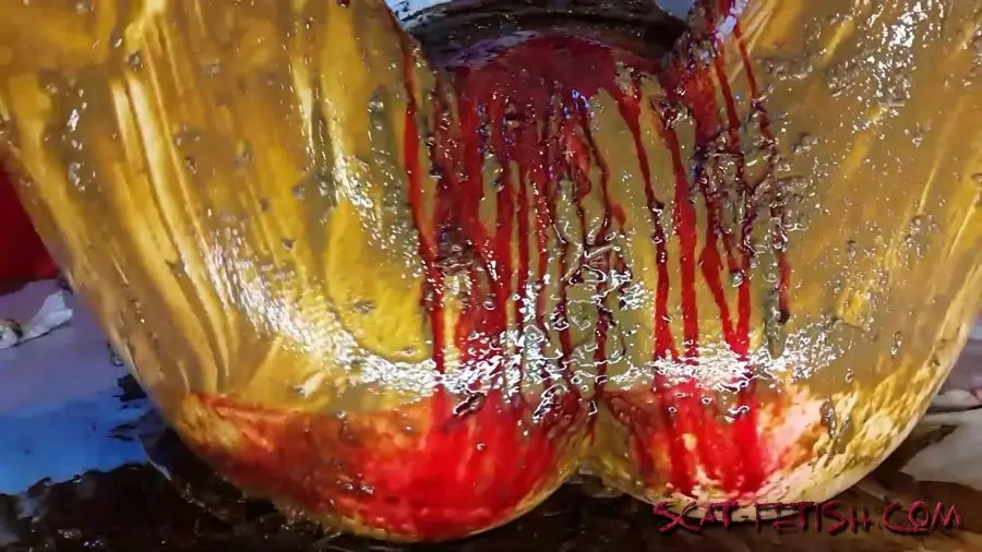 Shitting Ass (Anna Coprofield) Shit and Blood Vol.5 Speculum Part 2 [FullHD 1080p] Defecation, Solo