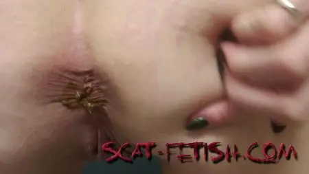 Scatting Girls (Sunnydelight69) The Extreme Closeup Poo [UltraHD 2K] Solo, Dirty Anal