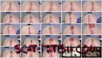 Solo (Dirtygardengirl) Wet Farts Prolapse [FullHD 1080p] Prolapse, Milf Screenshot 1