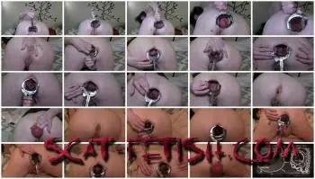 Dirty Anal (Dirtygardengirl) Speculum Compilation [FullHD 1080p] Scat, Solo Screenshot 1