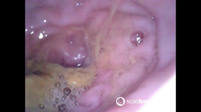 Scatbook.com (Sweet Tinqerbell) Show Inside Of My Ass With Endoscope [FullHD 1080p] Dildo, Anal