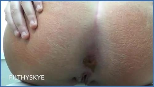 Filthy Skye's Wild Anal Gape and Dump - HD Scat Vid