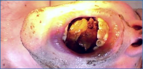 Lady Amy & Atropa's German Puke HD 720p – Scat-Slaves poster