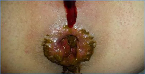 Download Anna Coprofield in Extreme Scat POV with Dirty Panties and Prolapse Scat-Slaves.net