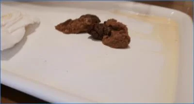 Badkitty España Defecates, Vomits, and Masturbates in Wild Solo Scat - related scat video at Scat-Fetish