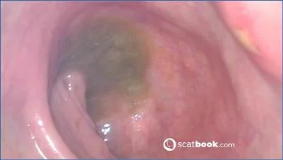 Download Insert Endoscope Sweet Tinqerbell Ass for Scat Scat-Fetish.com