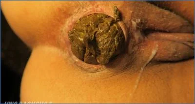 LoveRachelle2 in German Farting and Sex Toys Close-Up - scat porn video at Scat-Fetish.com